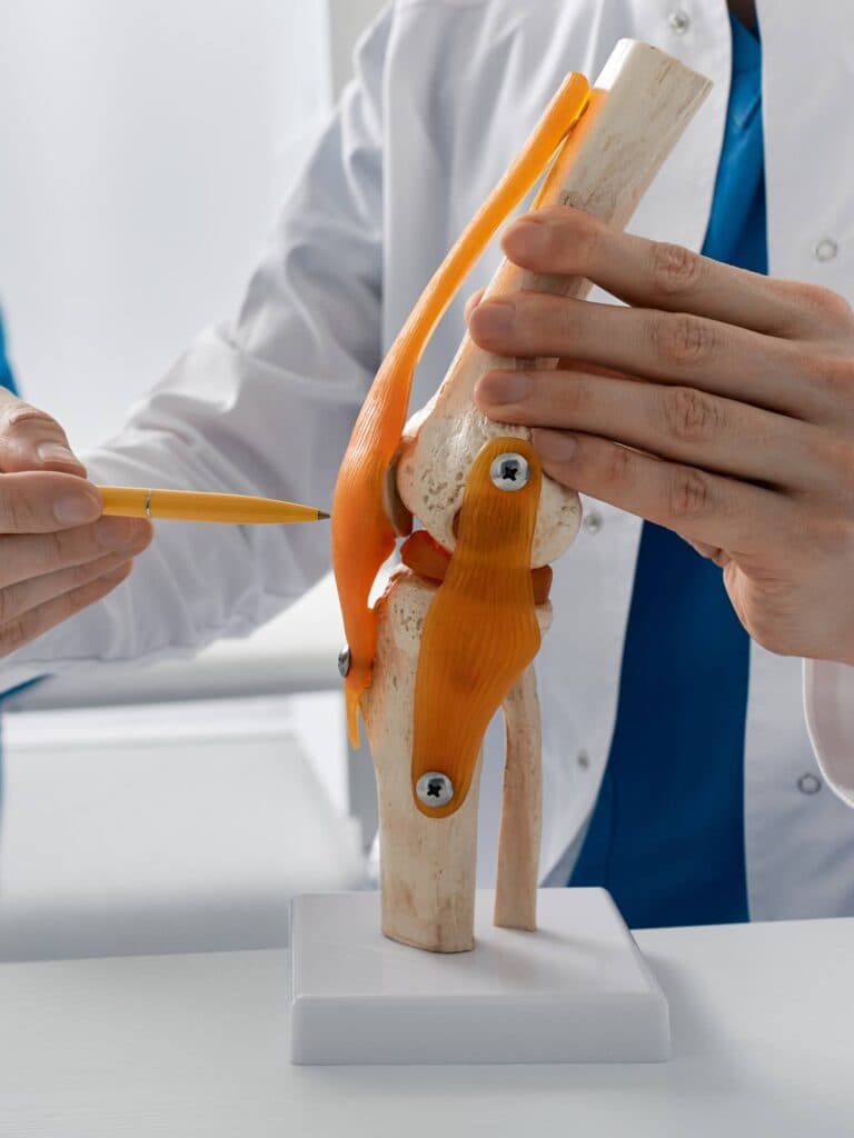 Arzt erklärt konservative Behandlung anhand eines Gelenkmodells